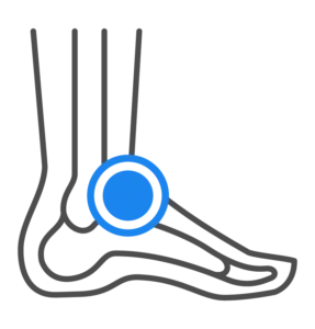 Foot and Ankle