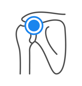 Shoulder/Upper Extremity